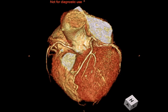 心臓画像診断